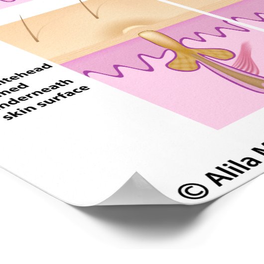 Poster met zwarte kop (Hoek)