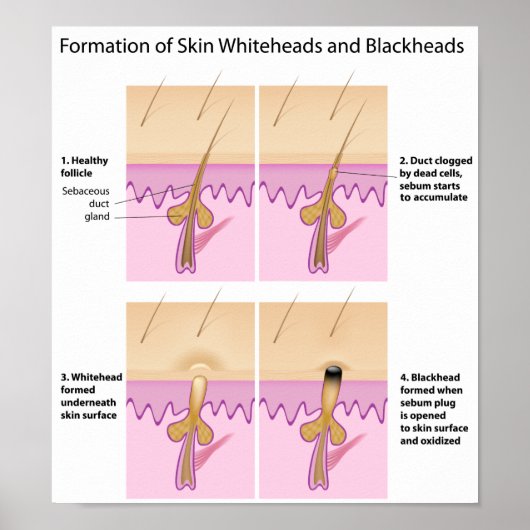 Poster met zwarte kop (Voorkant)