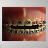 Modèle dentaire et bracelets de dents