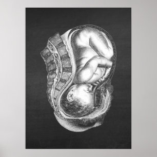 Poster OBGYN Anatomie Art Décor n° 3