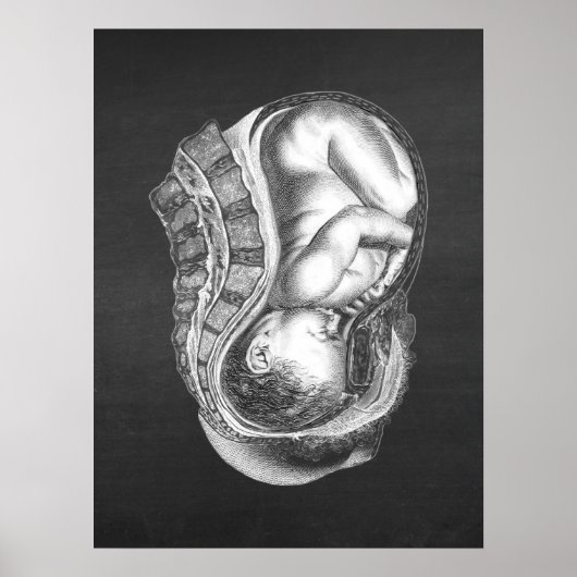 Poster OBGYN Anatomie Art Décor n° 3 (Devant)