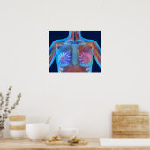 Poster OEuvre d'ordinateur représentant le cancer du sein (Cuisine)