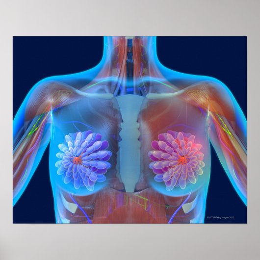 Poster OEuvre d'ordinateur représentant le cancer du sein (Devant)