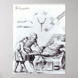 Poster Opération chirurgicale pour amputer une jambe
