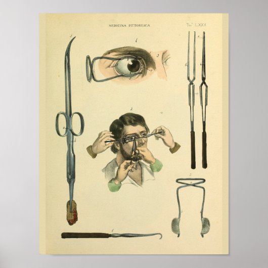 Poster Optométrie chirurgie oculaire Art Médicale Imprime (Devant)