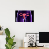 Poster Organe de reproduction féminin, vue par rayons X 1 (Bureau à domicile)