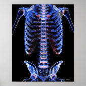 Poster Os du coffre 2 (Devant)