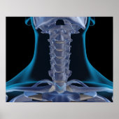 Poster Os du cou 2 (Devant)