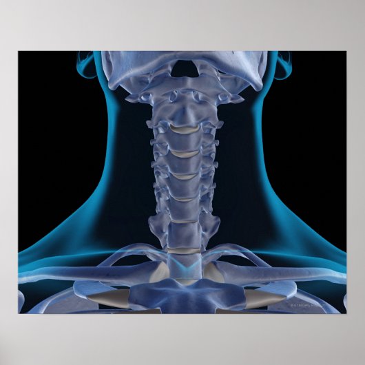 Poster Os du cou 2 (Devant)