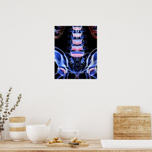 Poster Os du dos inférieur 5 (Cuisine)