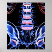 Poster Os du dos inférieur 5 (Devant)