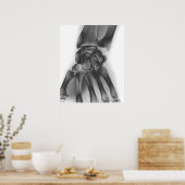 Poster Poignets normaux, rayons X (Cuisine)