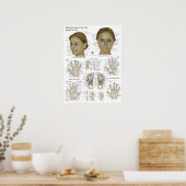 Poster Points d'acupression Visage Main Pieds (Cuisine)
