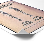 Poster Position Du Squelette En Bonne Et En Mauvaise Posi (Coin)