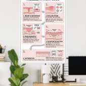 Poster Processus de guérison des plaies : 5 étapes de la  (Bureau à domicile)