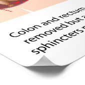 Poster Proctocolectomie réparatrice avec j-pouch 2 étapes (Coin)