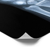 Poster Radiographie clinique de la main (Coin)