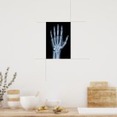 Poster Radiographie clinique de la main (Cuisine)