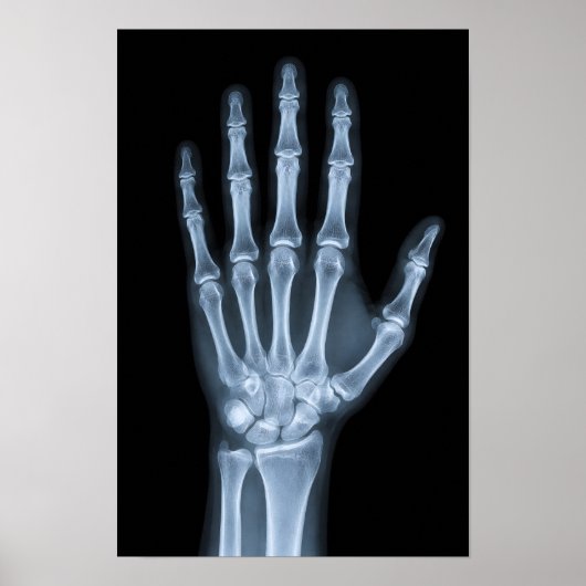 Poster Radiographie clinique de la main (Devant)