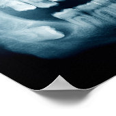 Poster Rayon X des dents (Coin)