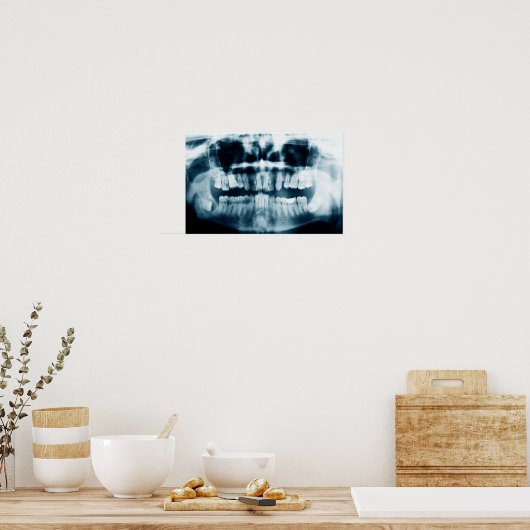Poster Rayon X des dents (Cuisine)