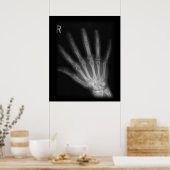 Poster Rayon X extra-numérique main droite (Cuisine)