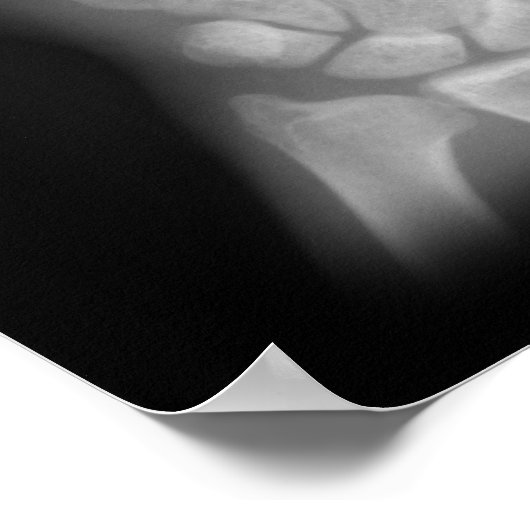 Poster Rayon X numérique supplémentaire, main droite et m (Coin)