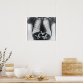 Poster rayons X de papillons dans l'estomac (Cuisine)
