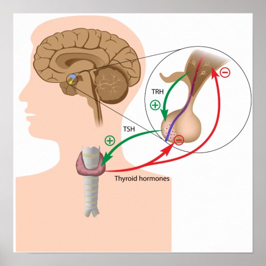 Poster Réaction négative sur l'axe thyroïdien hypophysair (Devant)