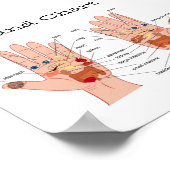 Poster Réflexologie manuelle 6x6" (Coin)