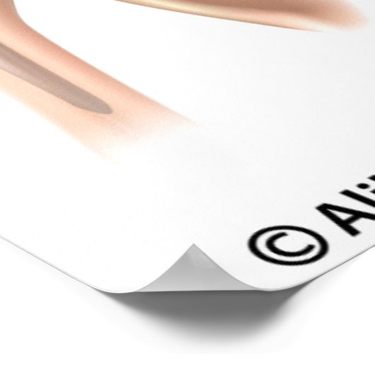 Poster Remplacement de l'épaule totale conventionnel par (Coin)