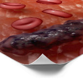 Poster Rendu microscopique d'une infection sanguine (Coin)