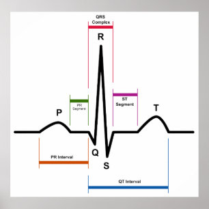 Poster Rythme sinus dans un diagramme ECG d'électrocardio
