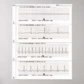 Poster rythmes ekg (Devant)