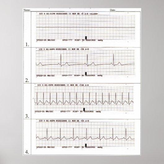 Poster rythmes ekg (Devant)