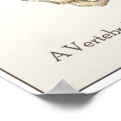 Poster Scoliose Spine (Coin)