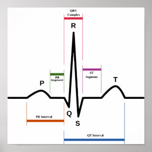 Poster Sinus rythm Electrocardiogramme ECG Diagram