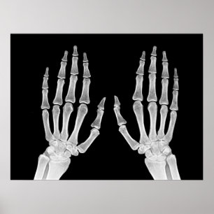 Poster Skeleton Hands Xray Photo Anatomie humaine photo