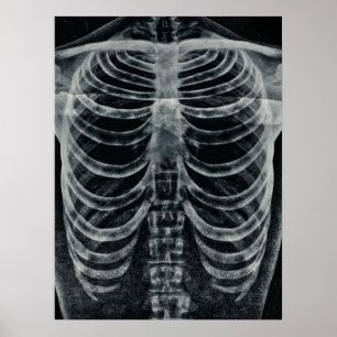 Poster Skeleton Xray Rib Cage Vintage noir blanc gothique