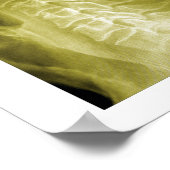 Poster Spinal Degeneration Cervical Spine Chiropractic (Coin)