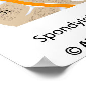 Poster Spondylolyse et spondylolisthèse, étiquetés (Coin)