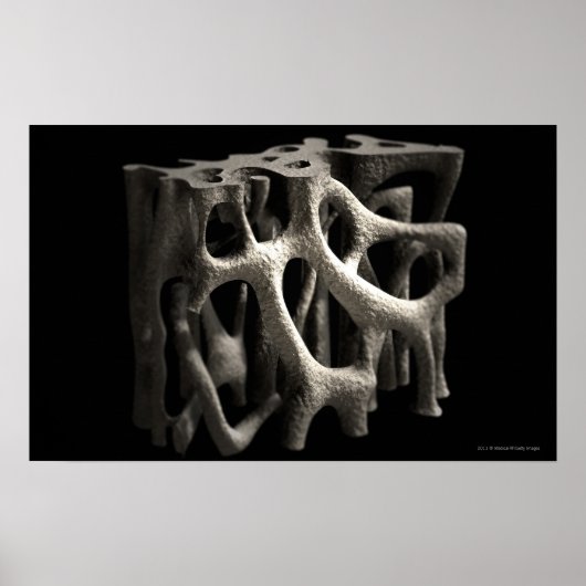 Poster Structure d'un os avec ostéoporose (Devant)