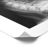 Poster Subluxation Espagnole Cervical Spinal Degeneration (Coin)