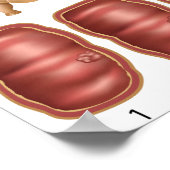 Poster sur la progression du cancer du côlon (Coin)