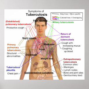 Poster Symptôme de la tuberculose chez l'homme