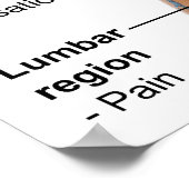 Poster Symptômes de la réaction hémolytique aiguë par tra (Coin)