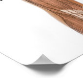 Poster Symptômes Graphique de la maladie du paludisme cau (Coin)