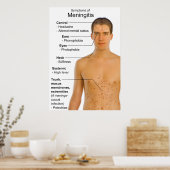 Poster Symptômes Graphique de l'inflammation Maladie Méni (Cuisine)