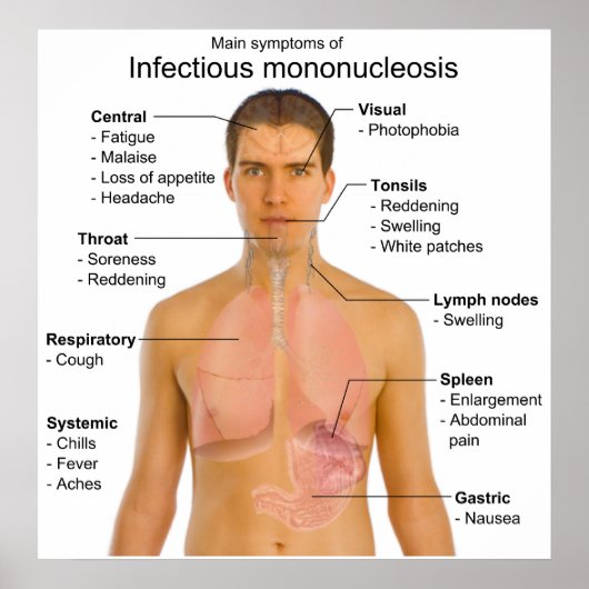 Poster Symptômes principaux de la mononucléose infectieus (Devant)