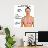 Poster Symptômes principaux de la tuberculose pulmonaire (Bureau à domicile)